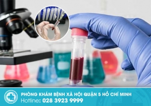 Hướng dẫn trị giang mai hiệu quả, ngăn ngừa tái phát